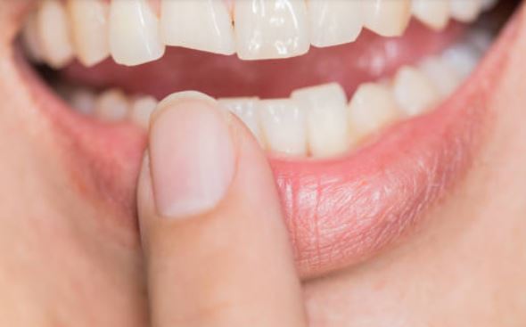 Broken tooth